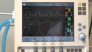 Introduction to Mechanical Ventilation [upl. by Tu997]