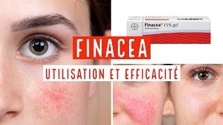 FINACEA 15  GEL [upl. by Eatnahc]