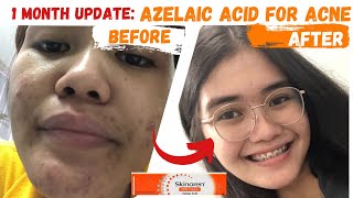 SKINOREN CREAM REVIEW  AZELAIC ACID [upl. by Nnahtur]