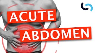 Acute Abdomen  Diagnosis and Management [upl. by Orteip]