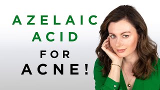 My Favourite Acne Treatments  Azelaic Acid  Dr Sam Bunting [upl. by Sremlahc]