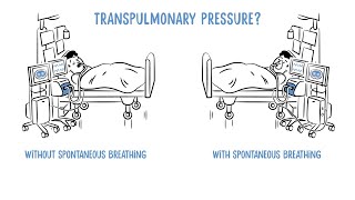 Transpulmonary Pressure Monitoring by Dräger [upl. by Ortensia]